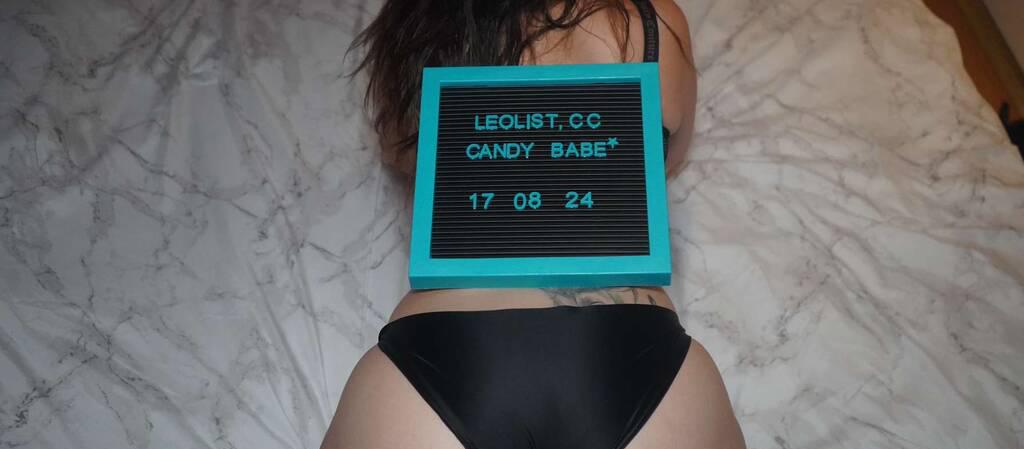 Candybabe is Female Escorts. | London | Ontario | Canada | scarletamour.com 