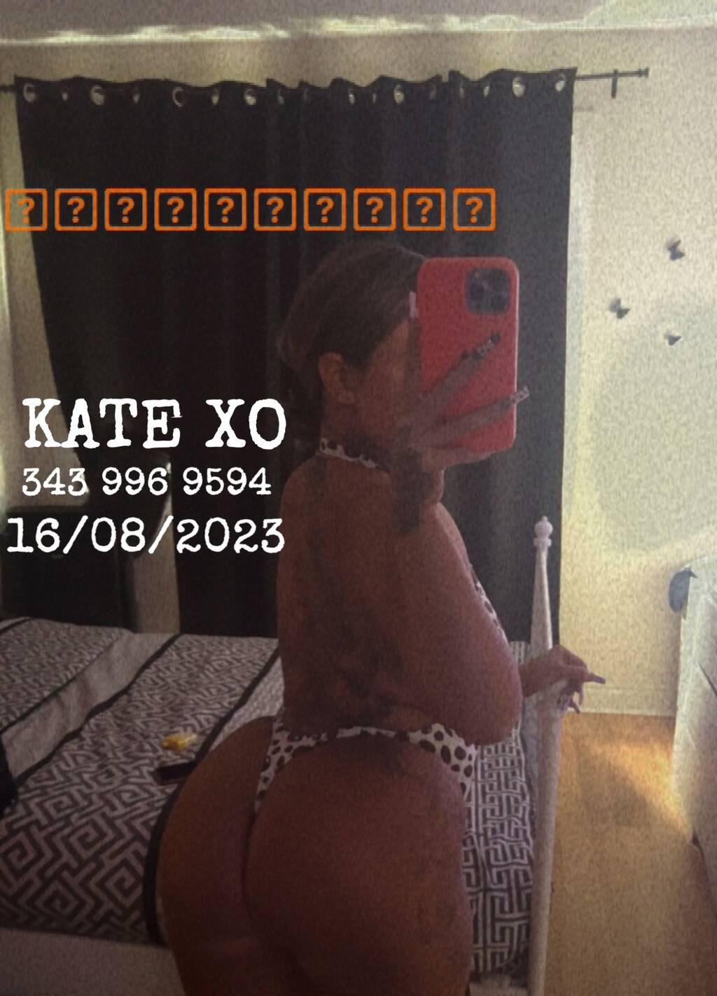 Kate Xo (Lost Contacts) is Female Escorts. | Niagara | Ontario | Canada | scarletamour.com 